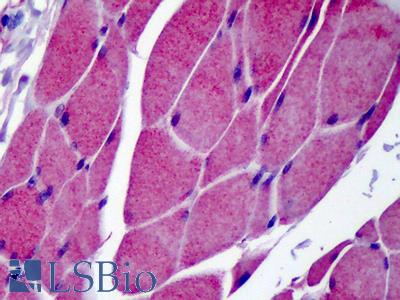 Anti-TRPC3 antibody IHC of human skeletal muscle. Immunohistochemistry of formalin-fixed, paraffin-embedded tissue after heat-induced antigen retrieval. Antibody LS-B187 concentration 5 ug/ml.