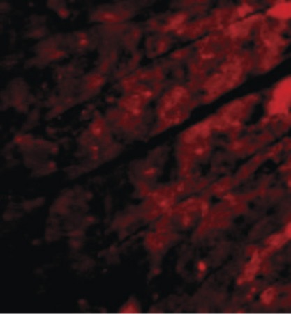 Immunofluorescence of TRPC3 in Mouse Heart cells with TRPC3 antibody at 20 ug/ml.