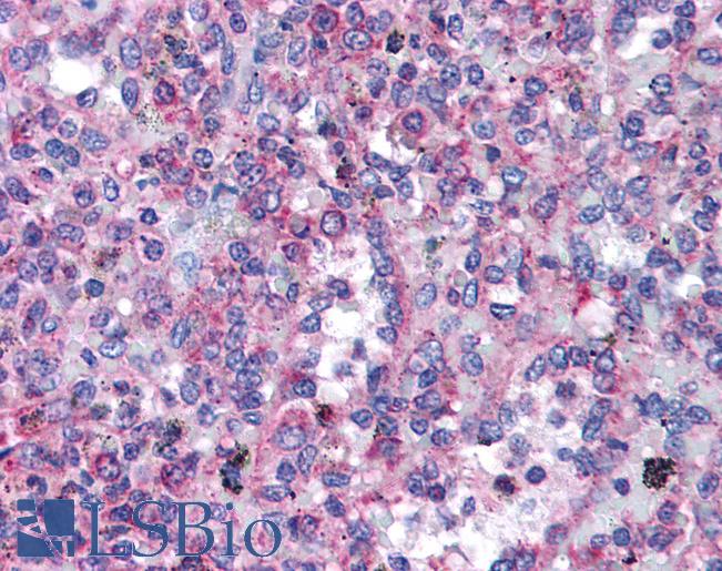 Anti-TRPC3 antibody IHC of human spleen. Immunohistochemistry of formalin-fixed, paraffin-embedded tissue after heat-induced antigen retrieval. Antibody LS-B186 concentration 5 ug/ml.
