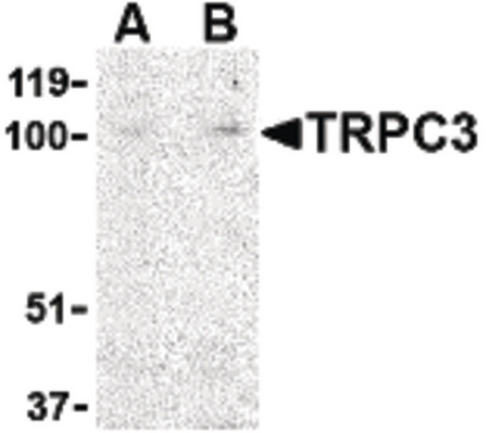 Western blot of TRPC3 in mouse heart tissue lysate with TRPC3 antibody at (A) 1 and (B) 2 ug/ml.