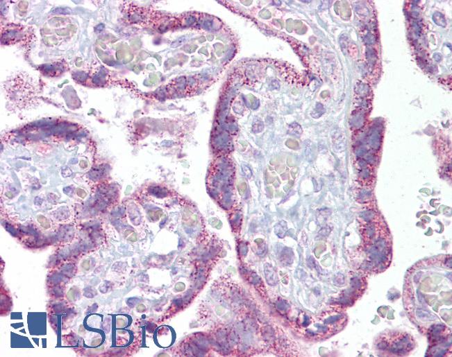 Anti-TRPC4 antibody IHC of human placenta. Immunohistochemistry of formalin-fixed, paraffin-embedded tissue after heat-induced antigen retrieval. Antibody LS-B6605 concentration 5 ug/ml.