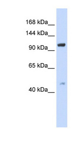 TRPC4 antibody LS-B6605 Western blot of 293T cell lysate.