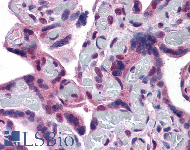 Anti-TRPC4 antibody IHC of human placenta. Immunohistochemistry of formalin-fixed, paraffin-embedded tissue after heat-induced antigen retrieval. Antibody LS-B4461 concentration 4.75 ug/ml.