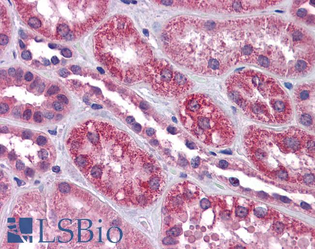 Anti-TRPC4 antibody IHC of human kidney. Immunohistochemistry of formalin-fixed, paraffin-embedded tissue after heat-induced antigen retrieval. Antibody LS-B4461 concentration 4.75 ug/ml.