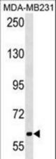 TRPC4AP Antibody western blot of MDA-MB231 cell line lysates (35 ug/lane). The TRPC4AP antibody detected the TRPC4AP protein (arrow).