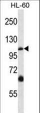 TRPC5 Antibody western blot of HL-60 cell line lysates (35 ug/lane). The TRPC5 antibody detected the TRPC5 protein (arrow).