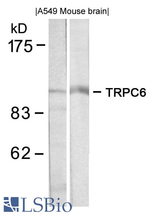 Western blot of extracts from A549 and mouse brain tissue using TRPC6 antibody.