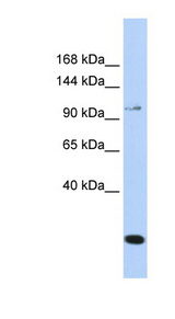 TRPC6 antibody LS-C112235 Western blot of MCF7 cell lysate.