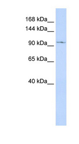 TRPC6 antibody LS-C109996 Western blot of MCF7 cell lysate.