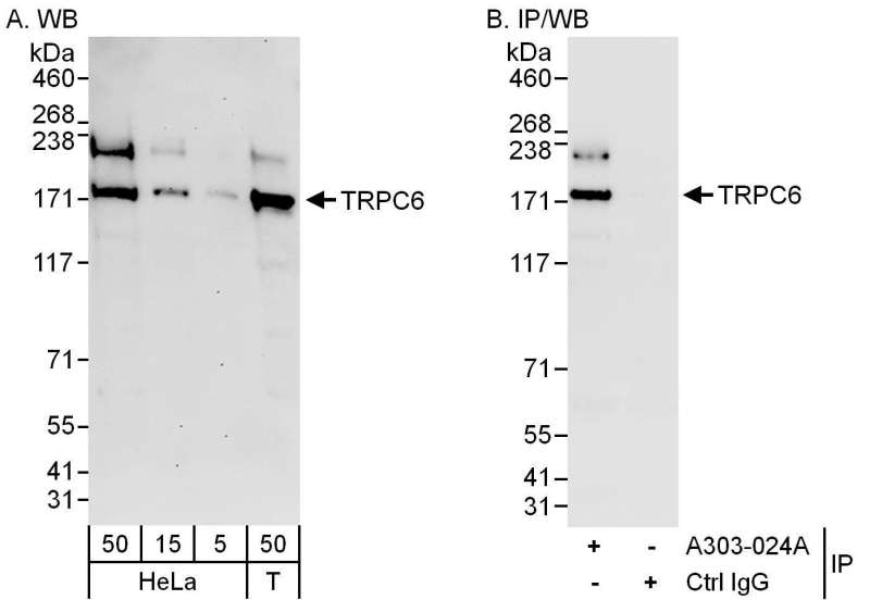 Detection of Human TRPC6 by Western Blot and Immunoprecipitation. Samples: Whole cell lysate from HeLa (5, 15 and 50 ug for WB; 1 mg for IP, 20% of IP loaded) and 293T (T; 50 ug) cells. Antibodies: Affinity purified rabbit anti-TRPC6 antibody used for WB at 0.04 ug/ml (A) and 1 ug/ml (B) and used for IP at 6 ug/mg lysate. Detection: Chemiluminescence with exposure times of 3 minutes (A) and 10 seconds (B).