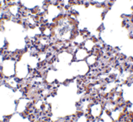 Immunohistochemistry of TRPC6 in mouse lung tissue with TRPC6 antibody at 10 ug/ml.