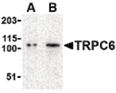 Western blot of TRPC6 in K562 cell lysate with TRPC6 antibody at (A) 0.5 and (B) 1 ug/ml.