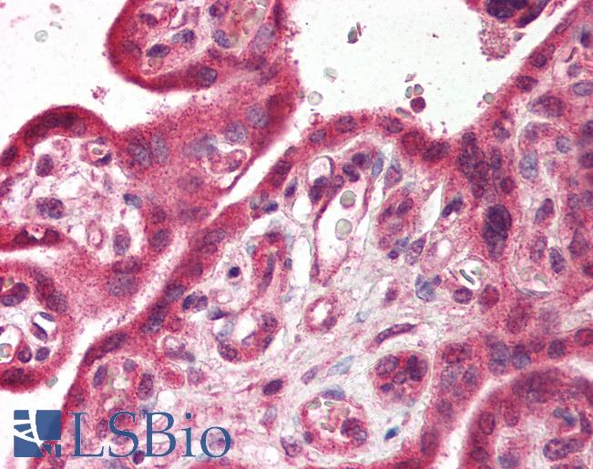 Anti-TRPC6 antibody IHC of human placenta. Immunohistochemistry of formalin-fixed, paraffin-embedded tissue after heat-induced antigen retrieval. Antibody LS-B611 concentration 5 ug/ml.