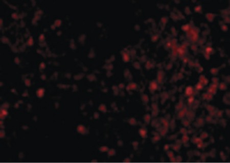 Immunofluorescence of TRPC6 in Mouse Lung cells with TRPC6 antibody at 20 ug/ml.