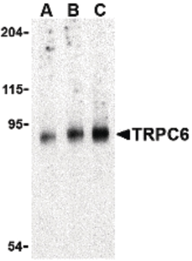 Western blot of TRPC6 in mouse lung tissue lysate with TRPC6 antibody at (A) 0.5, (B) 1 and (C) 2 ug/ml.