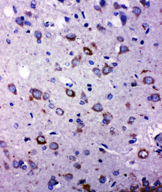 TRPC6 antibody. IHC(P): Rat Brain Tissue.