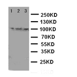WB of TRPC6 antibody. Lane 1: Rat Lung Tissue Lysate. Lane 2: 293T Cell Lysate. Lane 3: 293T Cell Lysate..