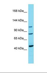 Western blot of Human Breast Tumor. TRPC7 antibody dilution 1.0 ug/ml.