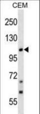 TRPC7 Antibody western blot of CEM cell line lysates (35 ug/lane). The TRPC7 antibody detected the TRPC7 protein (arrow).