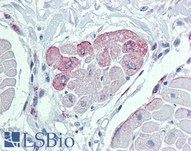 Anti-TRPM2 antibody IHC of human heart. Immunohistochemistry of formalin-fixed, paraffin-embedded tissue after heat-induced antigen retrieval. Antibody LS-B4013 concentration 10 ug/ml.