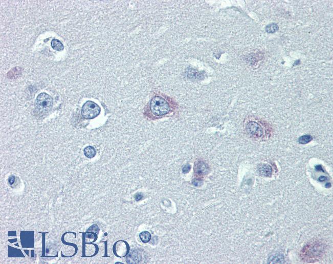 Anti-TRPM2 antibody IHC of human brain, cortex. Immunohistochemistry of formalin-fixed, paraffin-embedded tissue after heat-induced antigen retrieval. Antibody LS-B4013 concentration 10 ug/ml.