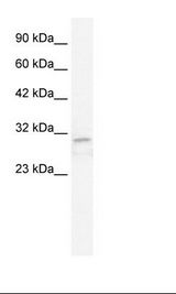 Jurkat Cell Lysate