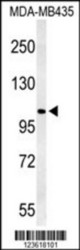 Western blot analysis of TRPM3 Antibody (N-term) in MDA-MB435 cell line lysates (35 ug/lane). TRPM3 (arrow) was detected using the purified Pab.