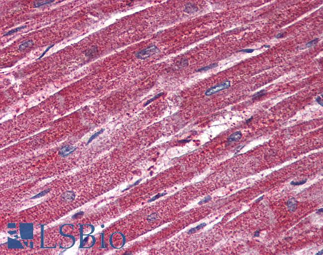 Anti-TRPM4 antibody LS-A8602 IHC of human heart. Immunohistochemistry of formalin-fixed, paraffin-embedded tissue after heat-induced antigen retrieval.