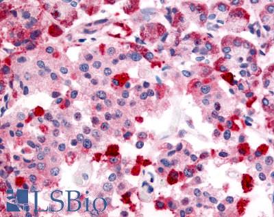 Anti-TRPM4 antibody LS-A8605 IHC of human pancreas. Immunohistochemistry of formalin-fixed, paraffin-embedded tissue after heat-induced antigen retrieval.