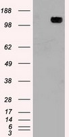 HEK293T cells were transfected with the pCMV6-ENTRY control (Left lane) or pCMV6-ENTRY TRPM4 (Right lane) cDNA for 48 hrs and lysed. Equivalent amounts of cell lysates (5 ug per lane) were separated by SDS-PAGE and immunoblotted with anti-TRPM4.