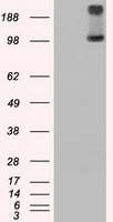 HEK293T cells were transfected with the pCMV6-ENTRY control (Left lane) or pCMV6-ENTRY TRPM4 (Right lane) cDNA for 48 hrs and lysed. Equivalent amounts of cell lysates (5 ug per lane) were separated by SDS-PAGE and immunoblotted with anti-TRPM4.
