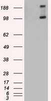 HEK293T cells were transfected with the pCMV6-ENTRY control (Left lane) or pCMV6-ENTRY TRPM4 (Right lane) cDNA for 48 hrs and lysed. Equivalent amounts of cell lysates (5 ug per lane) were separated by SDS-PAGE and immunoblotted with anti-TRPM4.