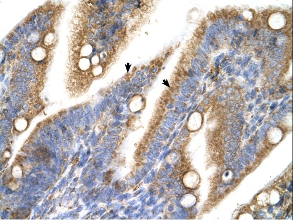 TRPM5 antibody LS-C80116 was used in IHC to stain formalin-fixed, paraffin-embedded human intestine.