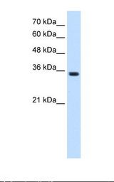 HepG2 cell lysate. Antibody concentration: 1.25 ug/ml. Gel concentration: 12%.