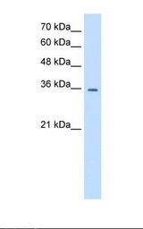 HepG2 cell lysate. Antibody concentration: 0.5 ug/ml. Gel concentration: 12%.