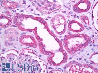 Anti-TRPM7 antibody IHC of human kidney, tubules. Immunohistochemistry of formalin-fixed, paraffin-embedded tissue after heat-induced antigen retrieval. Antibody LS-B7267 concentration 10 ug/ml.