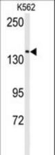 The anti-CHAK1 antibody is used in Western blot to detect CHAK1 in K562 cell lysate.