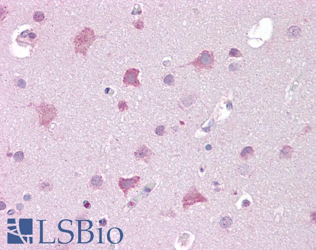 Anti-TRPM7 antibody IHC of human brain, cortex. Immunohistochemistry of formalin-fixed, paraffin-embedded tissue after heat-induced antigen retrieval. Antibody LS-B6930 concentration 10 ug/ml.