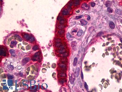 Anti-TRPM8 antibody IHC of human placenta, trophoblast. Immunohistochemistry of formalin-fixed, paraffin-embedded tissue after heat-induced antigen retrieval. Antibody LS-B6668 dilution 1:50.