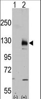 Western blot of TRPM8 (arrow) using rabbit polyclonal TRPM8 Antibody (C-term C940). 293 cell lysates (2 ug/lane) either nontransfected (Lane 1) or transiently transfected with the TRPM8 gene (Lane 2) (Origene Technologies).