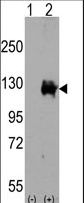 Western blot of TRPM8 (arrow) using rabbit polyclonal TRPM8 Antibody. 293 cell lysates (2 ug/lane) either nontransfected (Lane 1) or transiently transfected with the TRPM8 gene (Lane 2) (Origene Technologies).