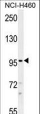 TRPM8 Antibody western blot of NCI-H460 cell line lysates (35 ug/lane). The TRPM8 antibody detected the TRPM8 protein (arrow).