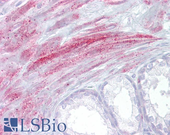 Anti-TRPM8 antibody IHC of human prostate. Immunohistochemistry of formalin-fixed, paraffin-embedded tissue after heat-induced antigen retrieval. Antibody LS-B6607 concentration 5 ug/ml.