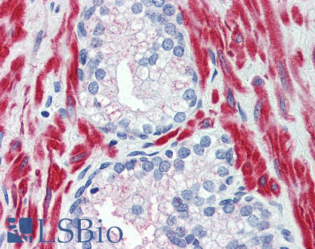 Anti-TRPM8 antibody LS-A8088 IHC of human prostate. Immunohistochemistry of formalin-fixed, paraffin-embedded tissue after heat-induced antigen retrieval.