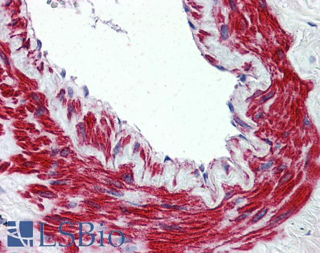 Anti-TRPM8 antibody LS-A8088 IHC of human lung, vessel. Immunohistochemistry of formalin-fixed, paraffin-embedded tissue after heat-induced antigen retrieval.