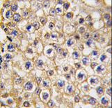 Formalin-fixed and paraffin-embedded human testis tissue reacted with TRPV3 Antibody , which was peroxidase-conjugated to the secondary antibody, followed by DAB staining. This data demonstrates the use of this antibody for immunohistochemistry; clinical relevance has not been evaluated.