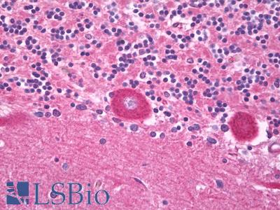 Anti-TRPV3 antibody IHC of human brain, cerebellum, Purkinje. Immunohistochemistry of formalin-fixed, paraffin-embedded tissue after heat-induced antigen retrieval. Antibody LS-B7773 dilution 10 ug/ml.