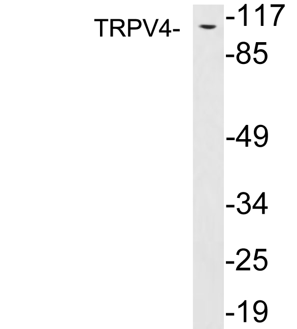 Western blot of extracts from PC12 cells, using TRPV4 antibody.