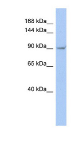 TRPV4 antibody LS-C110035 Western blot of HT1080 cell lysate.
