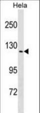 TRPV4 Antibody western blot of HeLa cell line lysates (35 ug/lane). The TRPV4 antibody detected the TRPV4 protein (arrow).